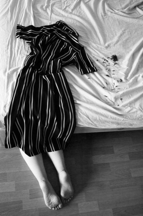 Striped dress laid on a bed as if worn, bare legs and feet extending onto the floor, cut hair beside it